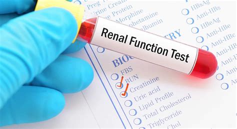 dropped kidney test|blood test for kidney failure.